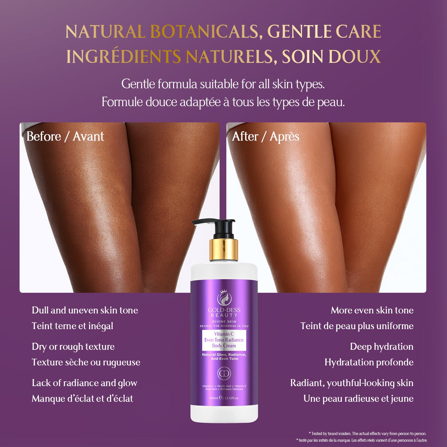 Vitamin C Even Tone Radiance Body Cream – 400 ml