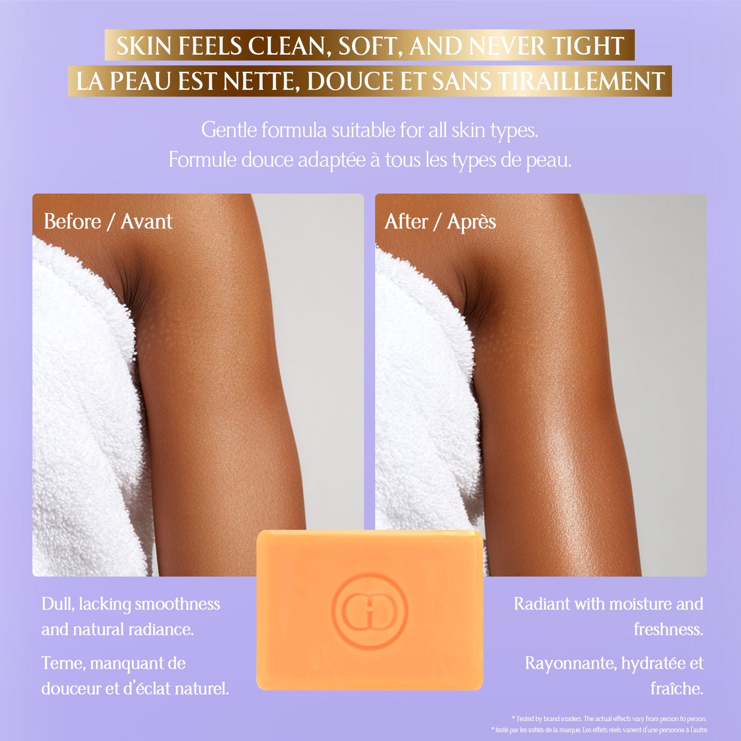 Vitamin C Glow Body Soap – 150 g