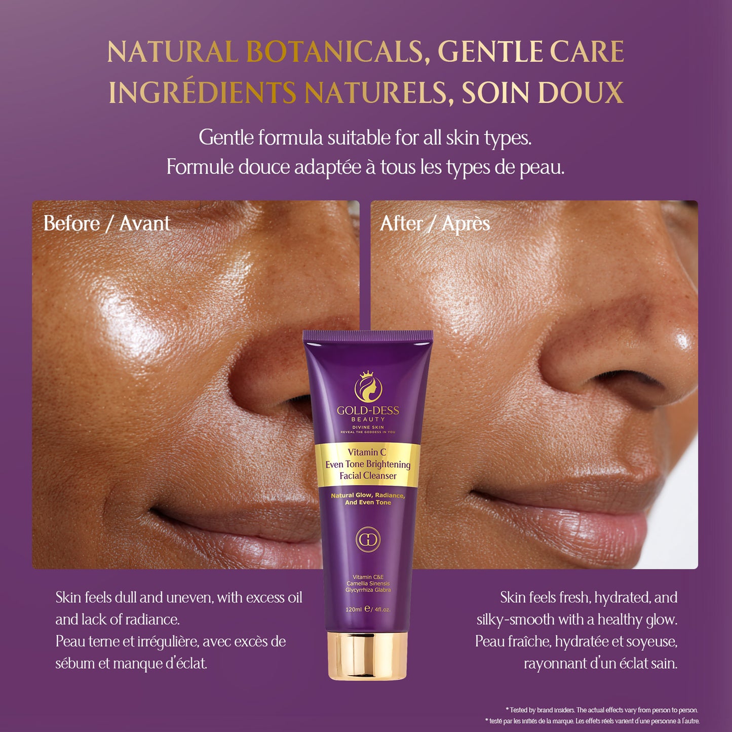 Vitamin C Even Tone Brightening Facial Cleanser – 120 ML